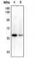 Anti-BRK Antibody